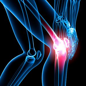 Knee pain isolated in black